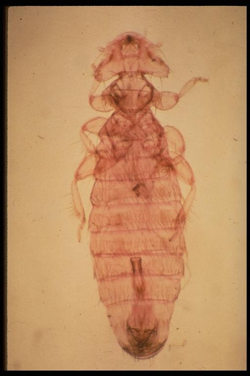 Chicken body louse, Menacanthus stramineus (Nitzsch) (Phthiraptera: Menoponidae). TAEX file photo.
